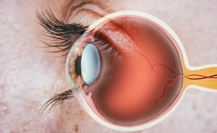 Eye Health Eye Health