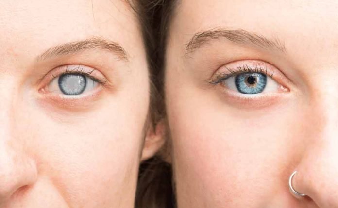 what-are-the-symptoms-of-cataracts-and-glaucoma-treatment